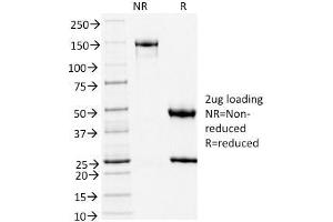 SDS-PAGE (SDS) image for anti-Transducin-Like Enhancer of Split 1 (E(sp1) Homolog, Drosophila) (TLE1) (AA 175-338) antibody (ABIN6940747)