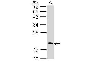 WB Image Sample (30 ug of whole cell lysate) A: Raji 12% SDS PAGE antibody diluted at 1:1000 (RGS13 antibody)
