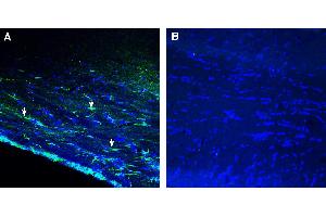 Expression of GPR143 in mouse corpus callosum.