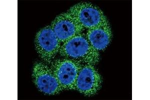 Confocal immunofluorescent analysis of DDR1 antibody with 293 cells followed by Alexa Fluor 488-conjugated goat anti-rabbit lgG (green). (DDR1 antibody  (AA 299-330))