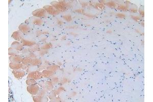 IHC-P analysis of Mouse Skeletal Muscle Tissue, with DAB staining. (IL-2 antibody  (AA 10-169))