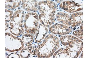 Immunohistochemical staining of paraffin-embedded Human Kidney tissue using anti-TTC32 mouse monoclonal antibody. (TTC32 antibody)