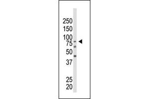The anti-EZH2 Ctr Pab (ABIN6244310 and ABIN6578917) is used in Western blot to detect EZH2 in mouse kidney tissue lysate. (EZH2 antibody  (AA 410-440))