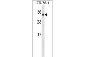 Western blot analysis in ZR-75-1 cell line lysates (35ug/lane).