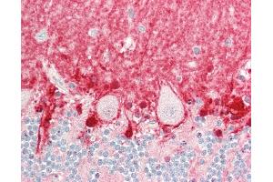 Human Brain, Cerebellum: Formalin-Fixed, Paraffin-Embedded (FFPE). (ICA1 antibody  (C-Term))