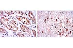 Immunohistochemical analysis of paraffin-embedded stomach tissues (left) and brain tissues (right) using OTX2 mouse mAb with DAB staining. (OTX2 antibody)