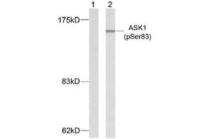 Western blot analysis of extracts from K562 cells using ASK1 (phospho-Ser83) antibody (E011178). (ASK1 antibody  (pSer83))