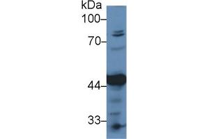 Detection of PDHA1 in Human Hela cell lysate using Polyclonal Antibody to Pyruvate dehydrogenase alpha 1 (PDHA1)