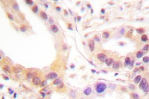 Image no. 1 for anti-V-Ets erythroblastosis Virus E26 Oncogene Homolog 1 (Avian) (ETS1) antibody (ABIN272023)
