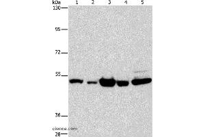 Western blot analysis of Human bladder carcinoma and brain malignant glioma tissue, A172 cell, human fetal brain tissue and hela cell, using PDE4D Polyclonal Antibody at dilution of 1:450 (PDE4D antibody)