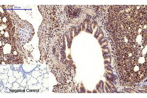 Immunohistochemical analysis of paraffin-embedded rat lung tissue. (Cadherin 5 antibody  (Internal Region))