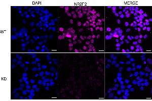anti-Nuclear Receptor Subfamily 2, Group F, Member 2 (NR2F2) antibody