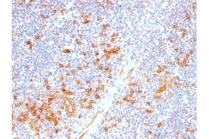 Formalin-fixed, paraffin-embedded human Tonsil stained with IL3RA / CD123 Rabbit Recombinant Monoclonal Antibody (IL3RA/2947R). (Recombinant IL3RA antibody  (AA 26-171))