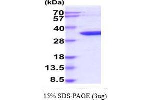 SDS-PAGE (SDS) image for Cyclin-Dependent Kinase 5 (CDK5) (AA 1-292) protein (His tag) (ABIN6388118) (CDK5 Protein (AA 1-292) (His tag))