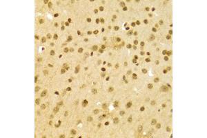 Immunohistochemistry of paraffin-embedded mouse brain using DKC1 Antibody (ABIN5970956) at dilution of 1/100 (40x lens). (DKC1 antibody)