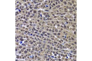 Immunohistochemistry of paraffin-embedded mouse cancer using GPS1 antibody at dilution of 1:100 (x400 lens). (GPS1 antibody)