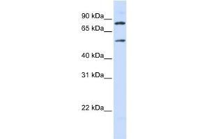 SLC27A4 antibody used at 1 ug/ml to detect target protein.