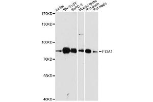 Western blot analysis of extracts of various cell lines, using F13A1 antibody (ABIN5974441) at 1:3000 dilution. (F13A1 antibody)