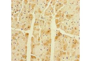 Immunohistochemistry of paraffin-embedded human heart tissue using ABIN7145063 at dilution of 1:100 (Corin antibody  (AA 1-110))