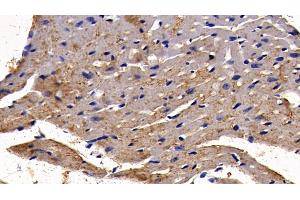 Detection of NFKB3 in Mouse Cardiac Muscle Tissue using Polyclonal Antibody to Transcription Factor P65 (NFKB3) (NF-kB p65 antibody  (AA 19-306))