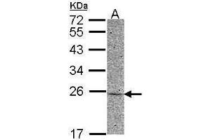 WB Image Sample (30 ug of whole cell lysate) A: HCT116 12% SDS PAGE antibody diluted at 1:500 (Adenylate Kinase 1 antibody)