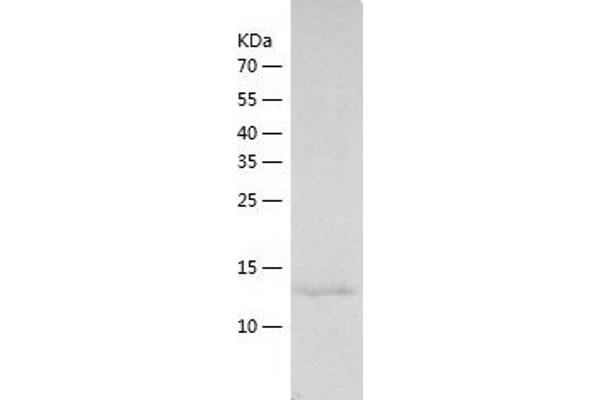 ITIH5 Protein (AA 35-161) (His tag)
