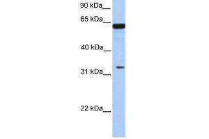 PERLD1 antibody used at 1 ug/ml to detect target protein. (PGAP3 antibody  (N-Term))