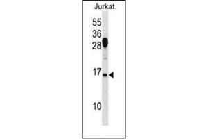 Western blot analysis of RhoG Antibody (C-term) in Jurkat cell line lysates (35ug/lane). (RHOG antibody  (C-Term))