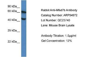 Western Blotting (WB) image for anti-Feline Leukemia Virus Subgroup C Cellular Receptor 1 (FLVCR1) (Middle Region) antibody (ABIN785718) (FLVCR antibody  (Middle Region))