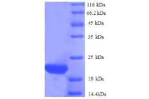 SDS-PAGE (SDS) image for ISG15 Ubiquitin-Like Modifier (ISG15) (AA 2-157) protein (His tag) (ABIN4976801)