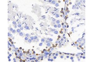 Immunohistochemistry analysis of paraffin-embedded rat testis using TSC22D3 Polyclonal Antibody at dilution of 1:300. (TSC22D3 antibody)