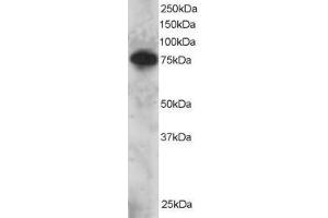 Image no. 1 for anti-SET Domain and Mariner Transposase Fusion Gene (SETMAR) (AA 671-684) antibody (ABIN297642)