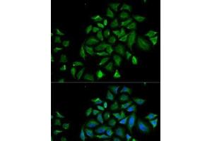 Immunofluorescence analysis of HeLa cells using FGFR1 Polyclonal Antibody (FGFR1 antibody)