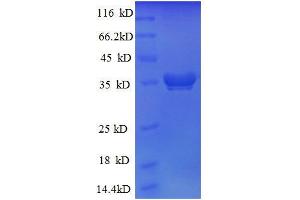 50S Ribosomal Protein L28 (AA 2-78), (full length) protein (GST tag)