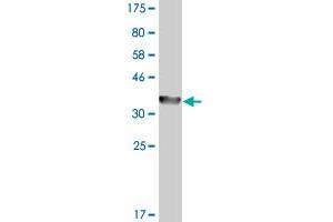 Western Blot detection against Immunogen (36. (ADH4 antibody  (AA 52-150))