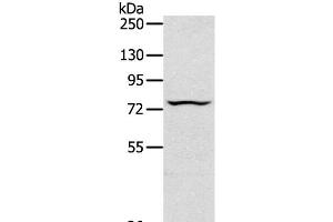 Western Blot analysis of Jurkat cell using TAP2 Polyclonal Antibody at dilution of 1:200 (TAP2 antibody)