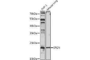 Western blot analysis of extracts of various cell lines, using SRGN antibody (ABIN6132570, ABIN6148440, ABIN6148442 and ABIN6217296) at 1:1000 dilution. (SRGN antibody  (AA 28-158))