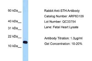 Western Blotting (WB) image for anti-Saitohin (STH) (Middle Region) antibody (ABIN2789376) (STH antibody  (Middle Region))