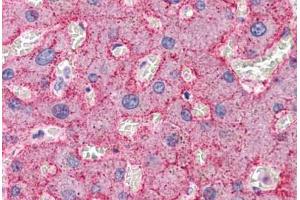 Human Liver: Formalin-Fixed, Paraffin-Embedded (FFPE) (CDC16 antibody  (N-Term))