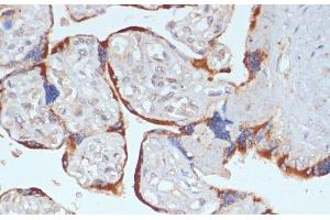 Immunohistochemistry of paraffin-embedded Human placenta using PDGFR beta Polyclonal Antibody at dilution of 1:100 (40x lens). (PDGFRB antibody)
