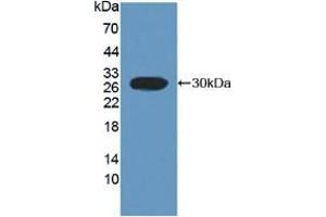 Detection of Recombinant FcaR, Rat using Polyclonal Antibody to Fc Fragment Of IgA Receptor (FcaR) (FCAR antibody  (AA 51-280))