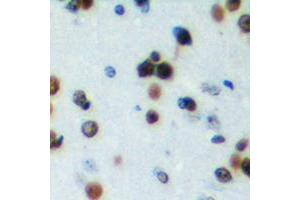 Immunohistochemical analysis of NRIP2 staining in human brain formalin fixed paraffin embedded tissue section. (NRIP2 antibody  (N-Term))