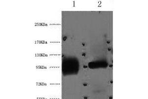 Western Blot analysis of 1) Hela, 2) 293T cells using ABCB5 Monoclonal Antibody at dilution of 1:2000. (ABCB5 antibody)