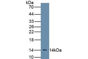 Detection of Recombinant CFB, Mouse using Polyclonal Antibody to Complement Factor B (CFB) (Complement Factor B antibody  (AA 32-157))