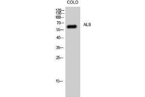 Western Blotting (WB) image for anti-Superoxide Dismutase 1, Soluble (SOD1) (Internal Region) antibody (ABIN3173762) (SOD1 antibody  (Internal Region))