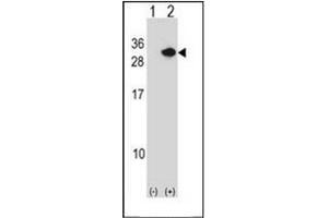 Western blot analysis of RCAN1 (arrow) using Calcipressin-1 Antibody . (RCAN1 antibody  (N-Term))