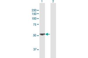 Western Blot analysis of PFKFB3 expression in transfected 293T cell line by PFKFB3 MaxPab polyclonal antibody. (PFKFB3 antibody  (AA 1-520))