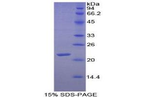 SDS-PAGE (SDS) image for Fibronectin (AA 510-689) protein (His tag) (ABIN1079560) (Fibronectin Protein (AA 510-689) (His tag))