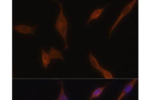 Immunofluorescence analysis of NIH-3T3 cells using MLPH Polyclonal Antibody at dilution of 1:100. (Melanophilin antibody)