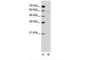 Image no. 1 for anti-Cell Division Cycle 23 (CDC23) (C-Term) antibody (ABIN6736648) (CDC23 antibody  (C-Term))